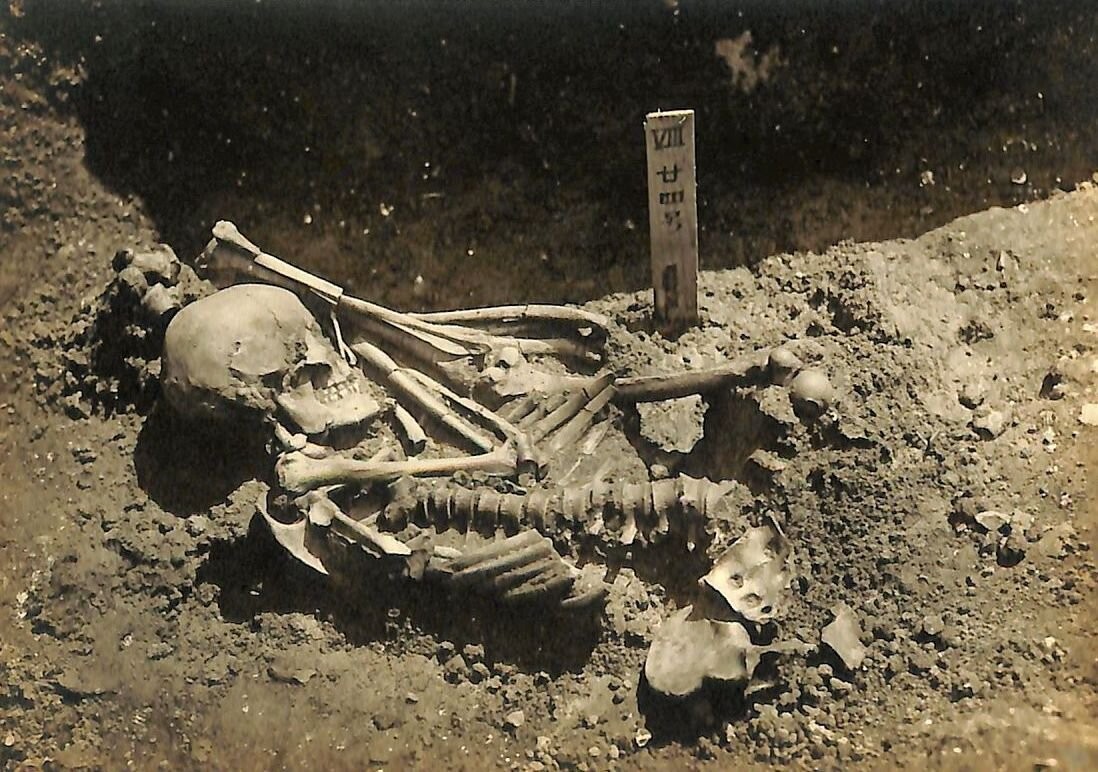 Researchers find 3,000-year-old shark attack victim
